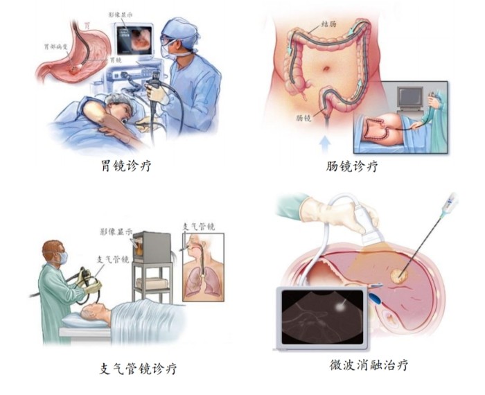 医用内窥镜介绍
