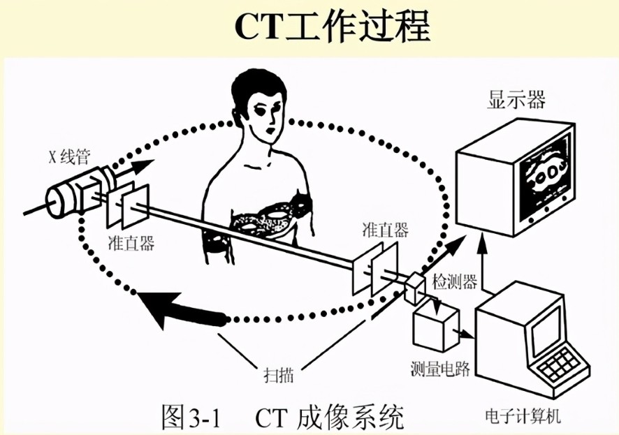 CT扫描仪成像道理