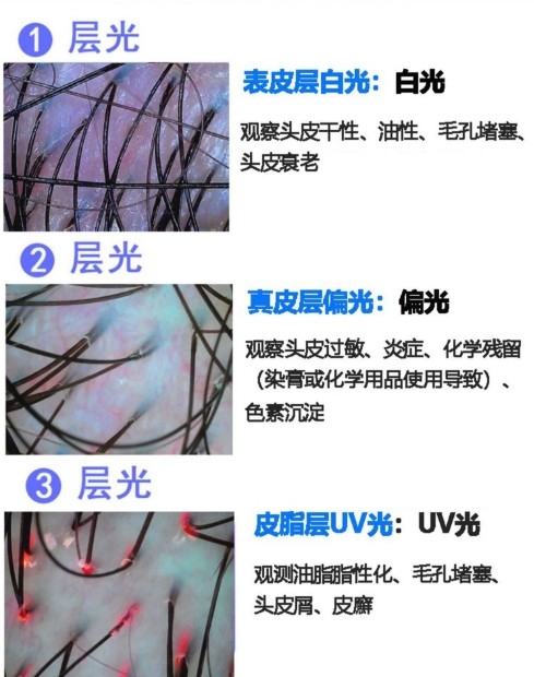 分歧光仇家发的观测成效