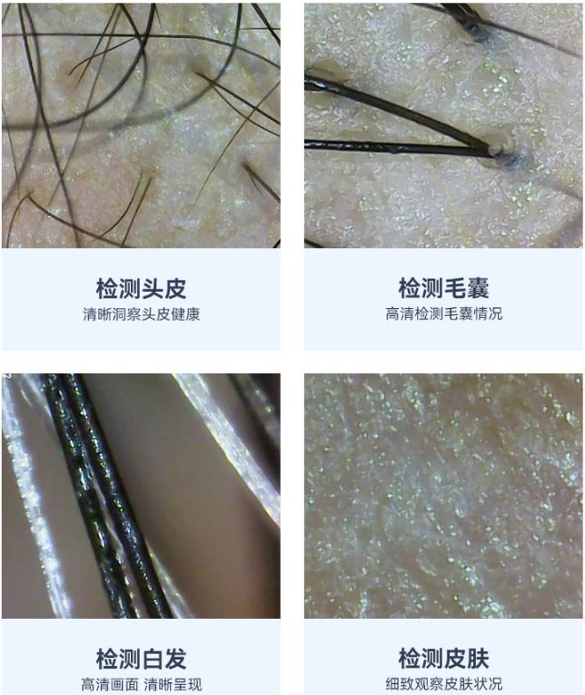 头皮检测仪的职能成效