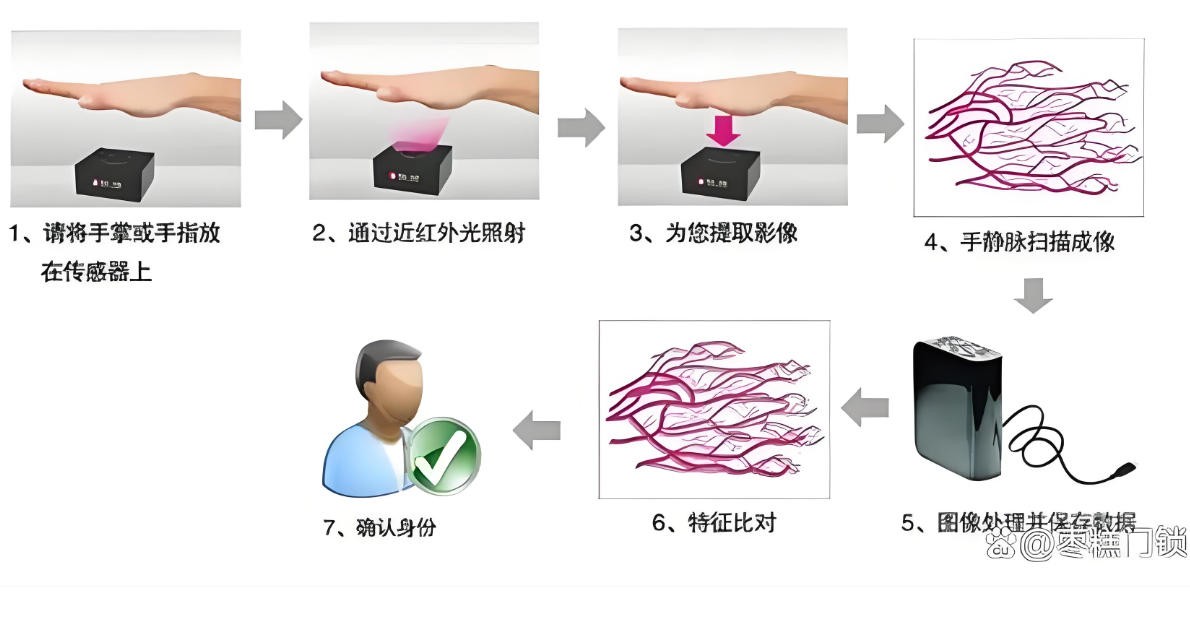 掌静脉鉴别图